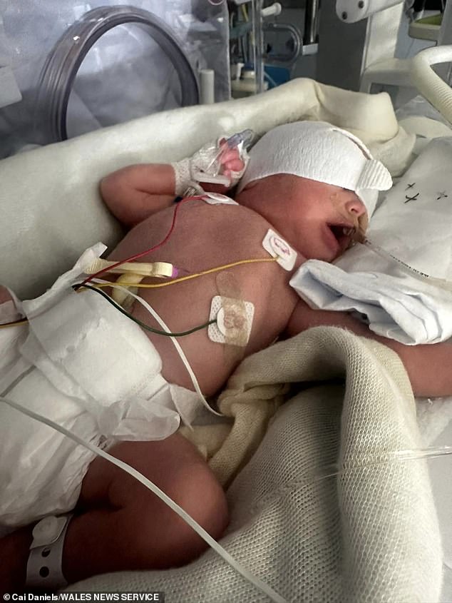 Doctors have told them they must stay in Tenerife for at least eight weeks until George, who weighed 1.5kg at birth, is strong enough to fly home.