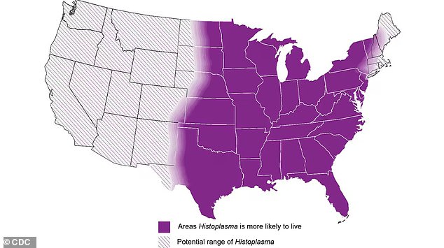 Above you can see the estimated areas in the US with histoplasmosis