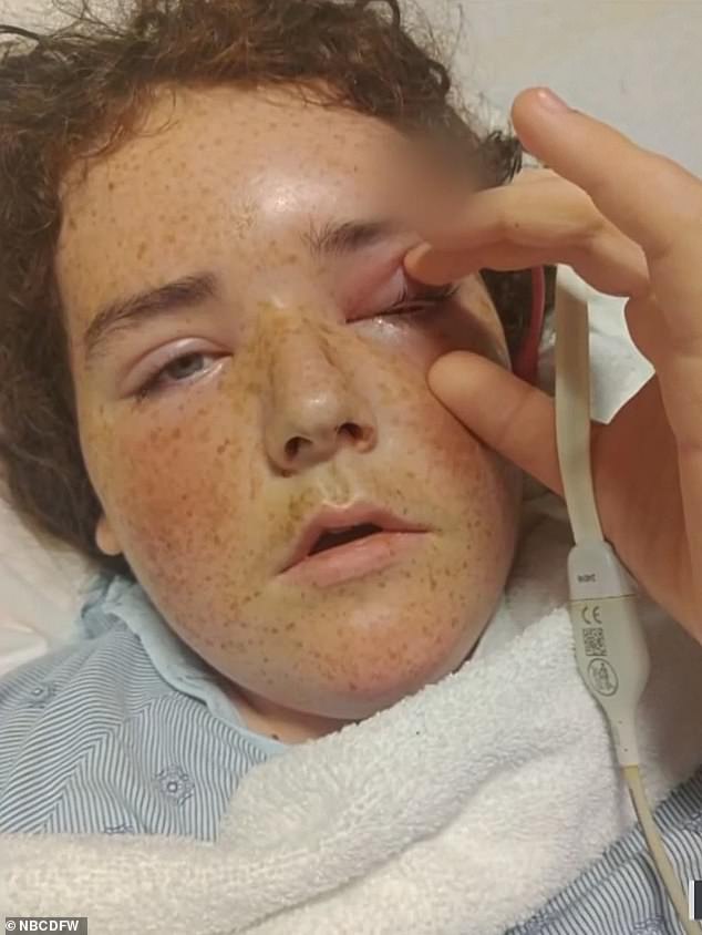 His mother, Kendra Smith, said the high school student's earache quickly turned into a severe headache during the night and he woke up with a swollen eye.