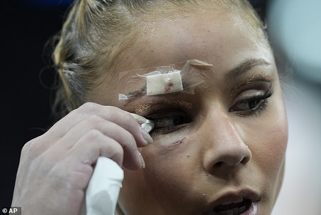 There was blood coming from her eyebrow - and swelling under her eye - after the fall