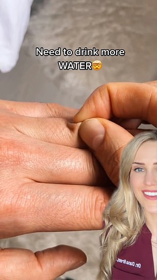 Dr. Dana Brems, a podiatrist in Los Angeles, posted a video on TikTok in April showing how pinching the skin on your finger can predict whether you need to drink more water