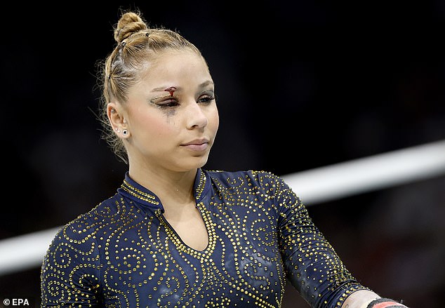 Brazilian gymnast Flavia Saraiva suffered a nasty injury during the Olympic team final in Paris