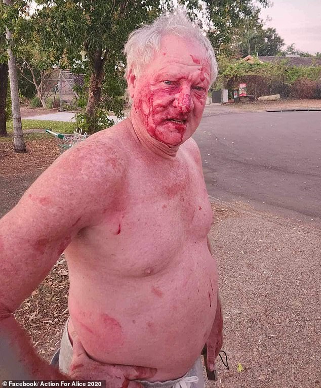 A bitter property dispute that broke out on a suburban street has left a man covered in blood