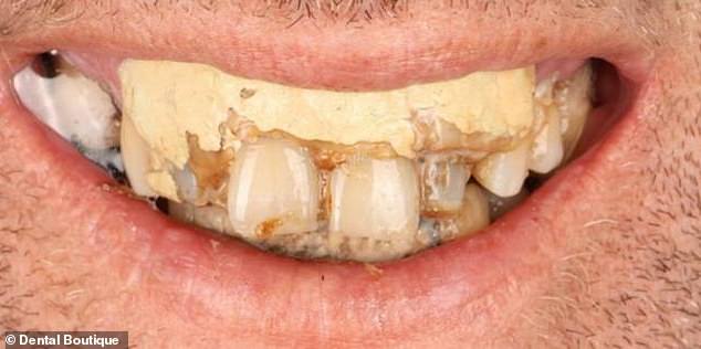 An Australian dentist has revealed the 'most terrifying' images he has found in a patient's mouth