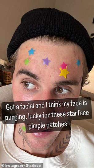 Justin Bieber has been spotted wearing pimple patches in recent years