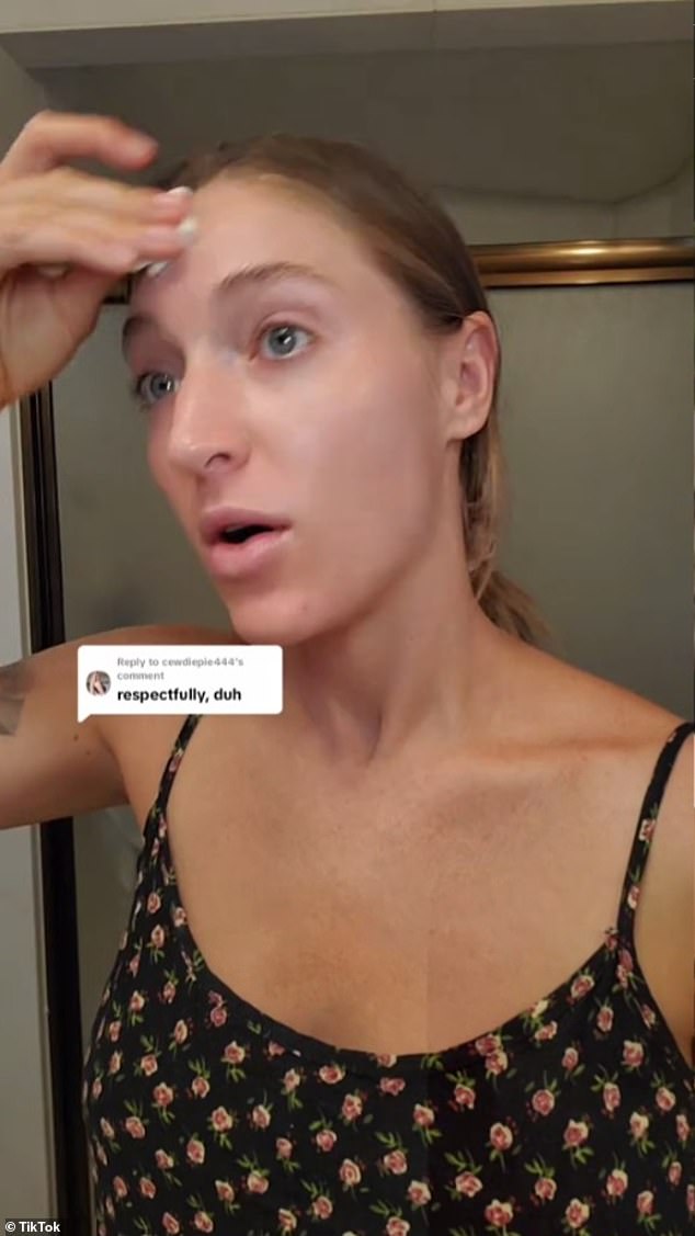 “We now have an explanation for the pillow face phenomenon, which is that fillers don't just dissolve or metabolize over time,” aesthetician Jayme B. explained to her TikTok followers.