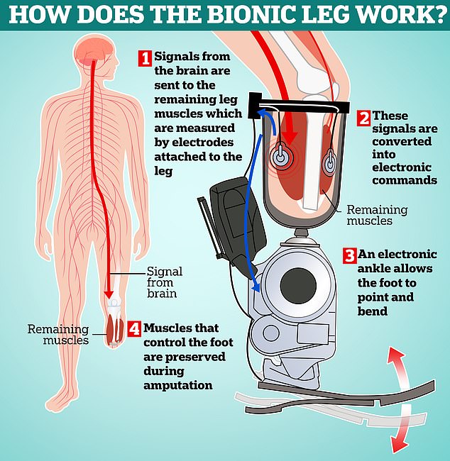 As this diagram shows, the bionic legs work by taking signals from the remaining muscles and converting them into commands for an electronic ankle