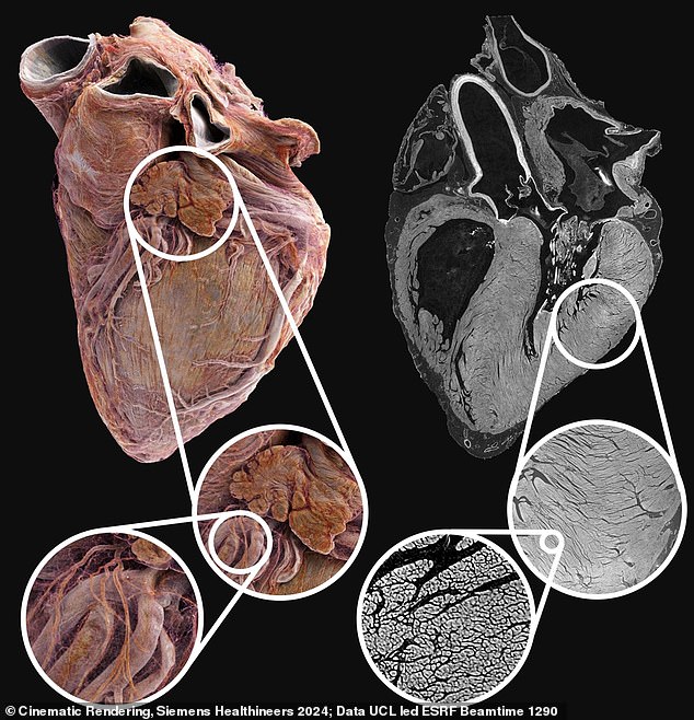 Inside The Human Heart: Shocking Video Reveals The Difference Between A ...