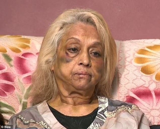 Ninette Simons (pictured) was admitted to hospital after sustaining multiple injuries during the alleged burglary of her home