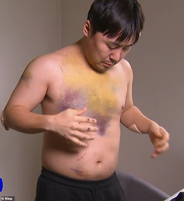 Jinwoo Song, 30, was left battered and bruised after the terrifying ordeal