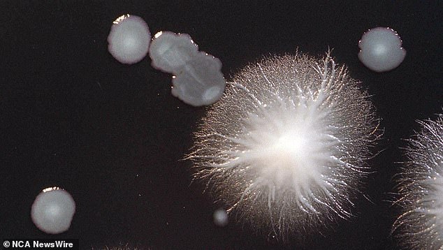 Legionella bacteria at the Victorian Infectious Diseases Reference Laboratory, May 1, 2000. Legionella disease