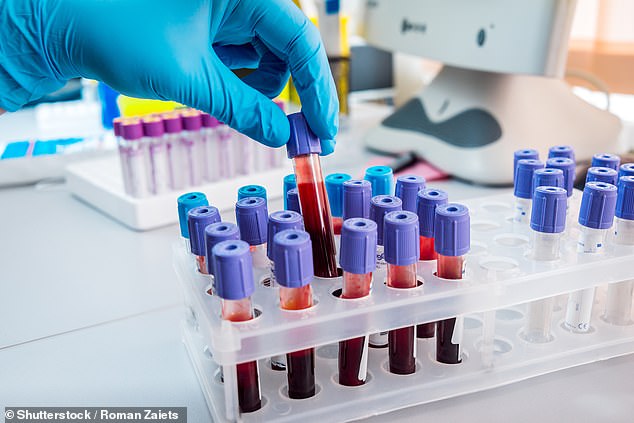 New research has found that blood tests that target a form of protein called tau are much more accurate in diagnosing the disease than doctors alone