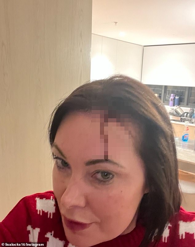 Lisa Oldfield (pictured) has left fans worried after sharing a photo on Instagram of her bleeding from her head. 