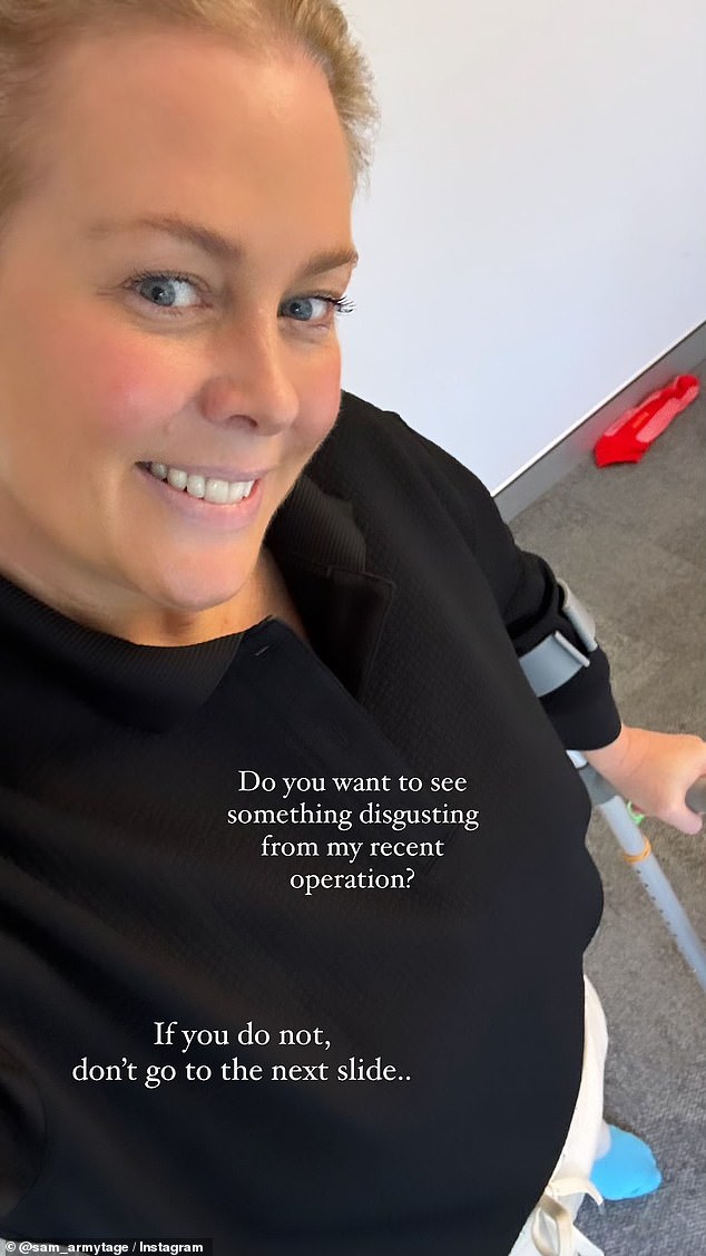 Samantha Armytage (pictured) has shared a gruesome object removed from her body after hip surgery
