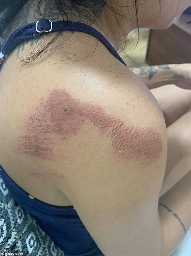 Brazilian school principal Raquel Schwab suffered multiple bruises after being dragged by a driver she had asked not to park on the school sidewalk