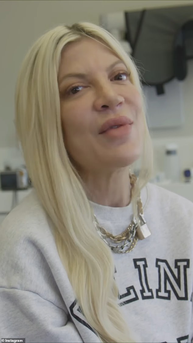 Tori Spelling has given fans a glimpse into the veneer procedure that boosted her confidence and made her 'smile again'