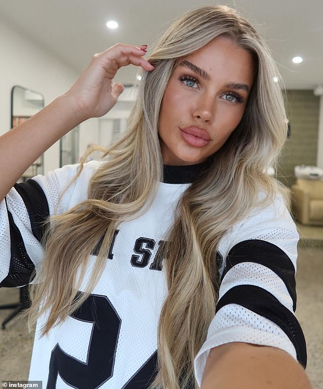 Australian influencers have flocked to Turkey in recent years for cheap and quick plastic surgery. Pictured: Skye Wheatley