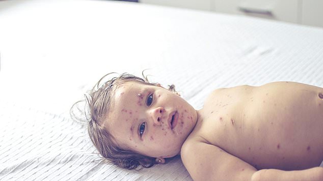 Unvaccinated babies are at greatest risk. Photo: iStock