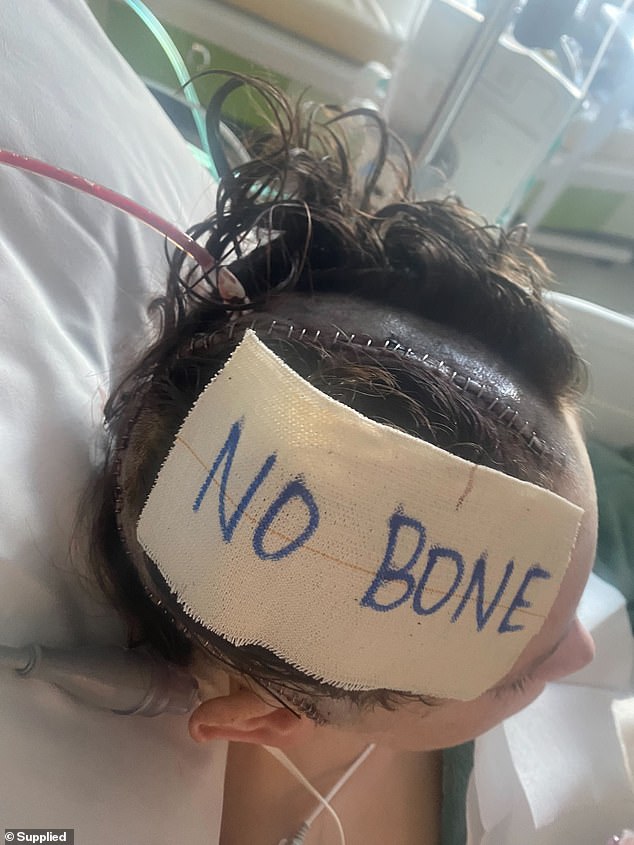 He woke up on his 14th birthday to the news that a large part of his skull had been removed. As he talks, he has nerve damage in his right eye and will have to learn to walk again