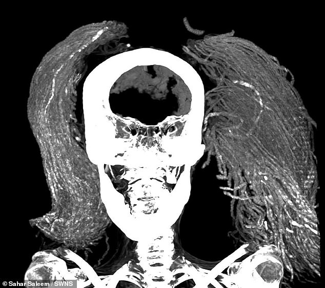 The mummy was found with her brain, diaphragm, heart, lungs, liver, spleen, kidneys and intestines still present