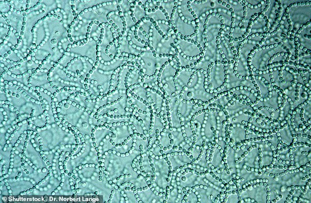 Dangerous bacteria can also lead to fatal sepsis, coma, amputation of limbs and death in the worst cases. (Pictured: stock photo of cyanobacteria in water)