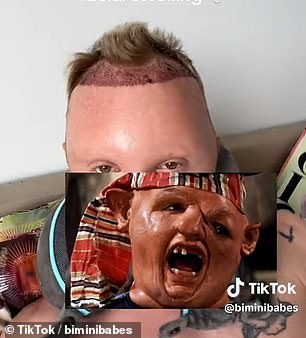 ...but said casually that it gave them a resemblance to Sloth from The Goonies