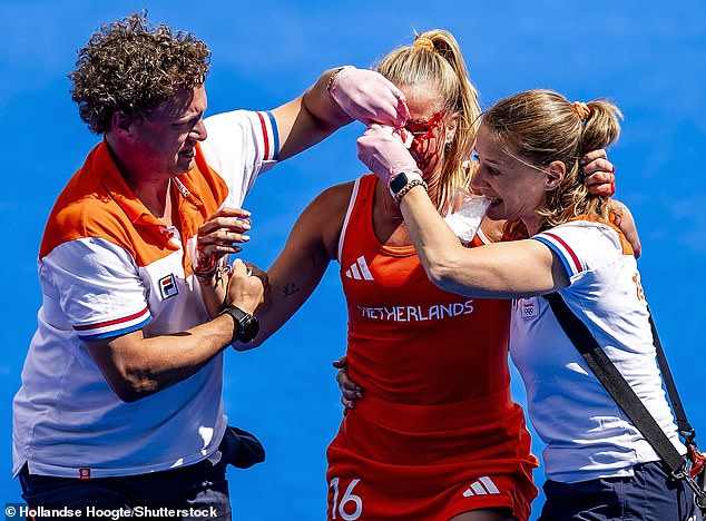 The Dutch star was hit in the face with a hard shot on Wednesday