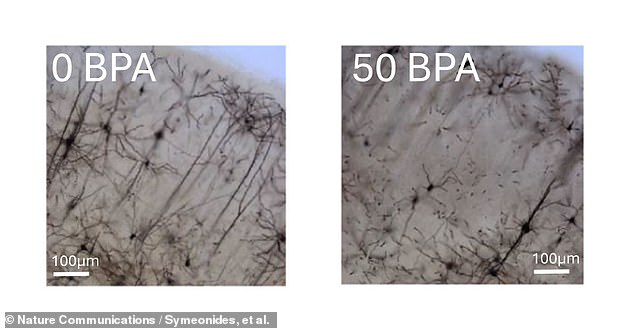 In addition to surveying more than 600 human children, who have been followed since 2010, the study also tested laboratory mice to track the effect of BPA on brain development and autism. Photomicrographs of cortical neurons in laboratory mice (above) show the damaging impact of BPA