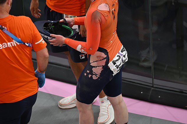 Van der Pet suffered burns on the track, as her left leg showed signs of her clothing having been worn away