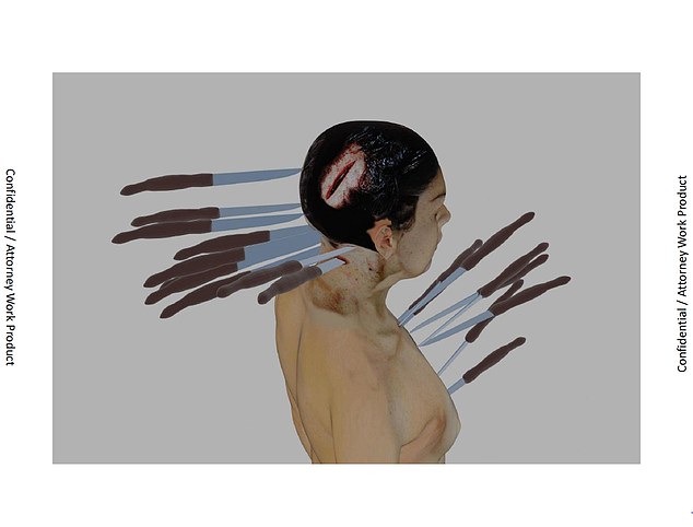 This image shows the stab wounds Ellen sustained to her neck and chest, penetrating her brain and severing her spinal cord