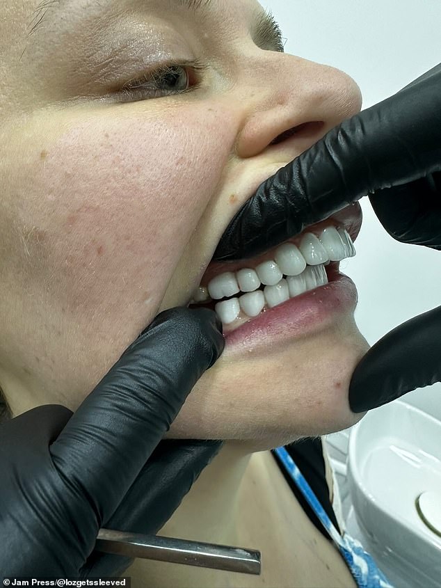 Ms Evans, a content creator with over 11,500 followers online, decided to fly back to Turkey to have her teeth fixed