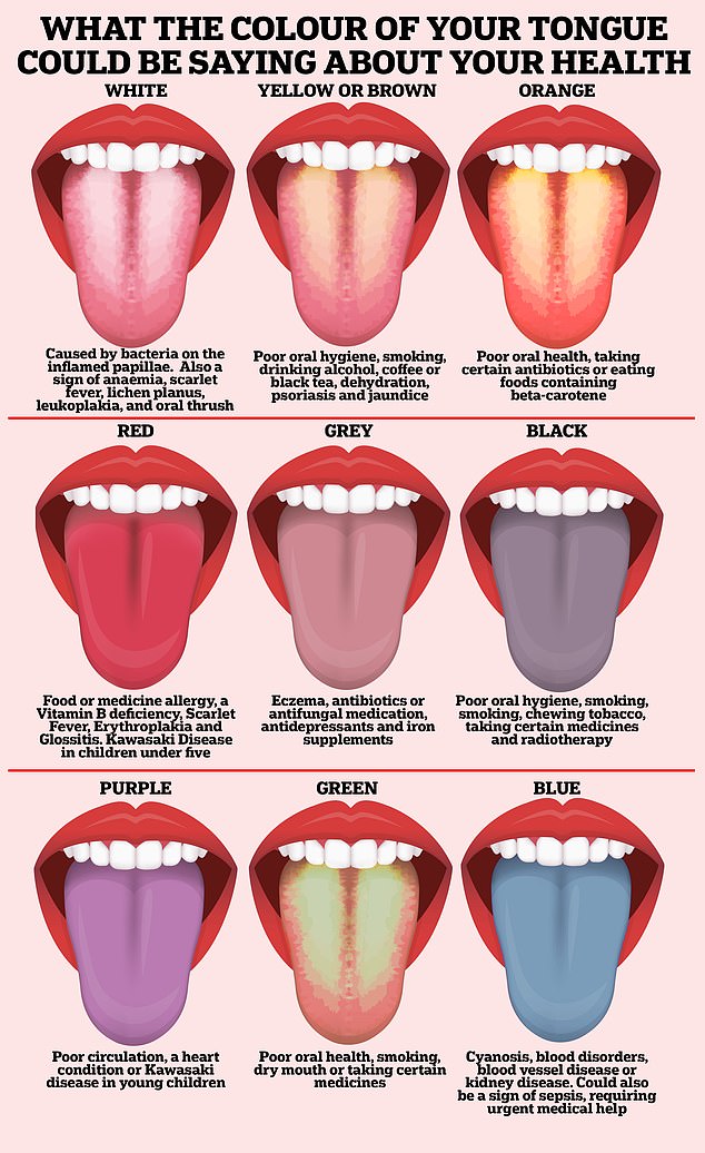 Examining the tongue for signs of disease is a 2,000-year-old practice widely used in traditional Chinese medicine, explains lead author Professor Ali Al-Naji