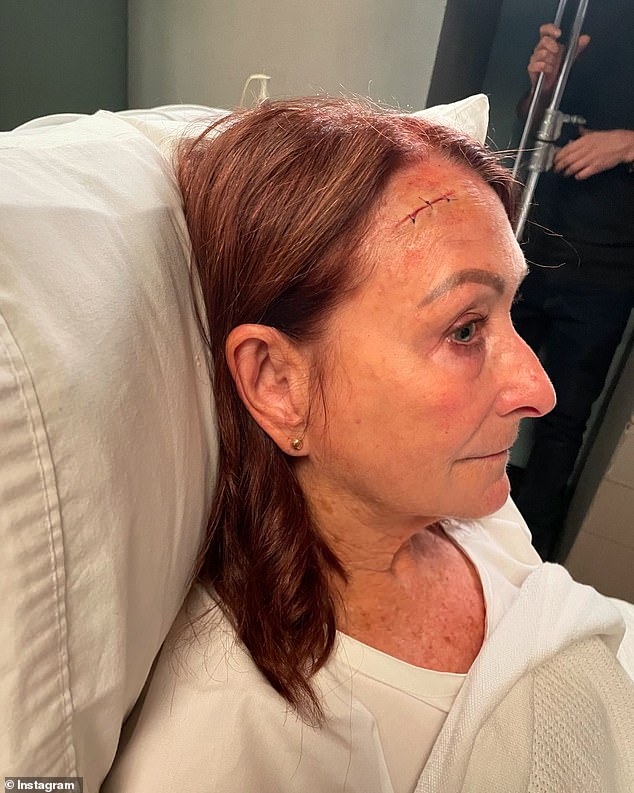 The Home and Away veteran posted the photos to Instagram on Tuesday, but thankfully it was all just special effects makeup