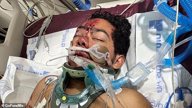 Anthony Rosales fights for his life in a local hospital after the crash