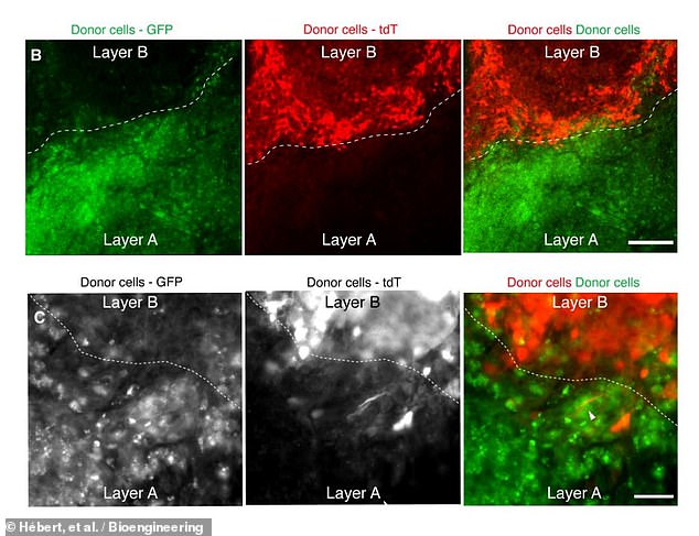 The ARPA-H project will extend geneticist Dr. Jean Hébert's tests of his surgical technique from previously successful transplants in mice to primates and other animals. Above, microscopic 'immunofluorescence' images show the successful layers of new brain cells in mice