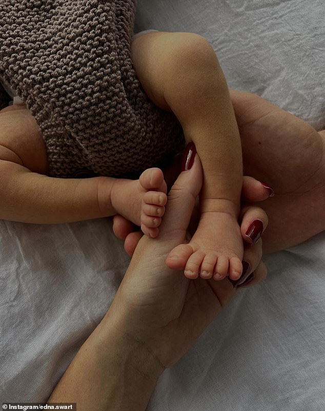 The next morning Edna was upset when the baby's heart rate started to slow. They then decided to perform surgery with 20 doctors in the room - including three pediatricians - and within five minutes the baby was born