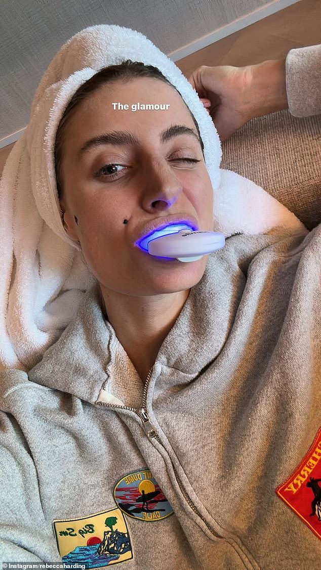 Rebecca Harding, whose fiancé Andy Lee is up for a Gold Logie this year, took to her Instagram Story to show off the incredible work it takes to keep her smile looking its best