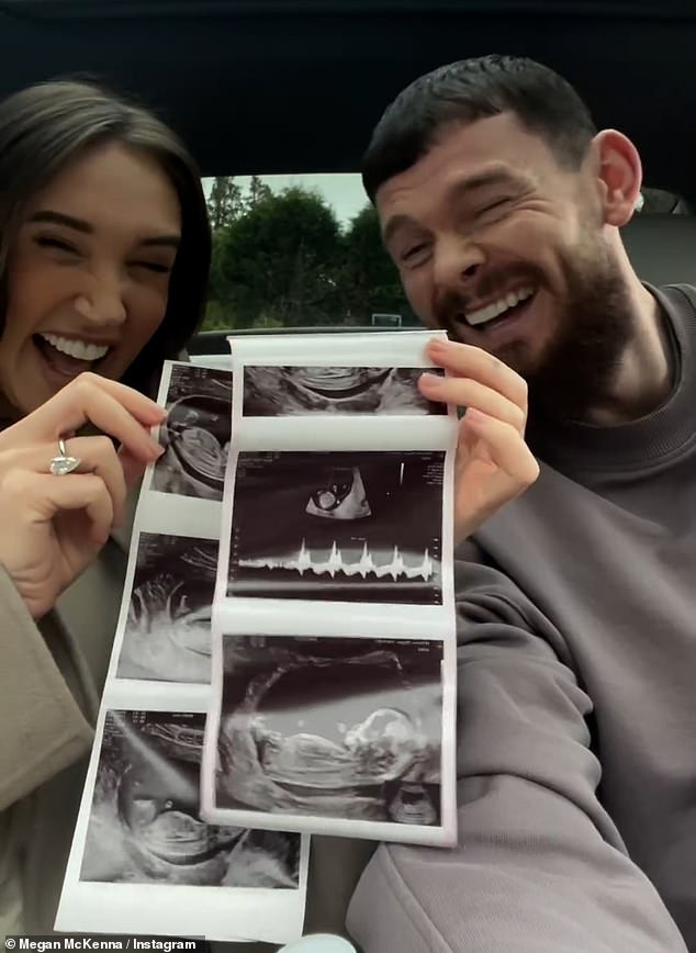 Megan fell pregnant after undergoing IVF treatment and has been documenting her pregnancy journey for her fans on social media and has been candid about her struggles