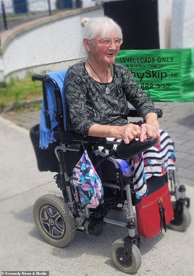 The compression bandages slowed her circulation so much that her toes turned black, leaving her with no choice but to have both legs amputated above the knee.