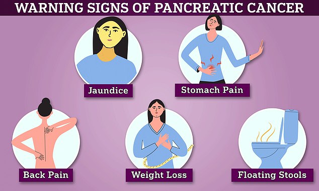 Pancreatic cancer is called a 'silent killer' because of the subtle symptoms that are often not noticed until too late