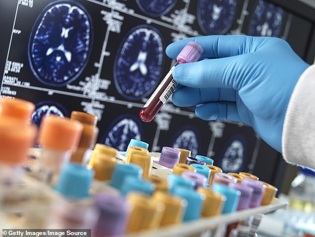 A scientist picks up a sample to be used for research into Alzheimer's disease