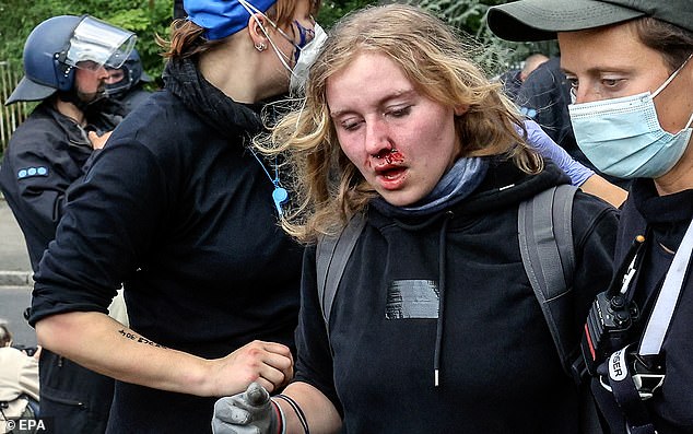 A protester is seen bleeding as police officers restrain environmental activists during a protest against Tesla's plans to expand its Gigafactory plant, in Gruenheide, near Berlin, Germany, May 10, 2024