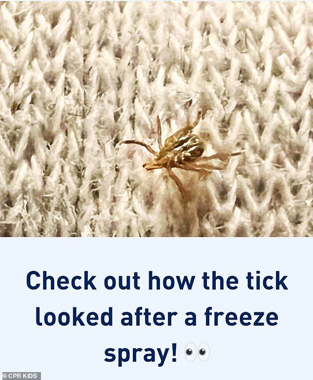 After the tick was frozen with a spray containing ether, it died and fell off her abdomen