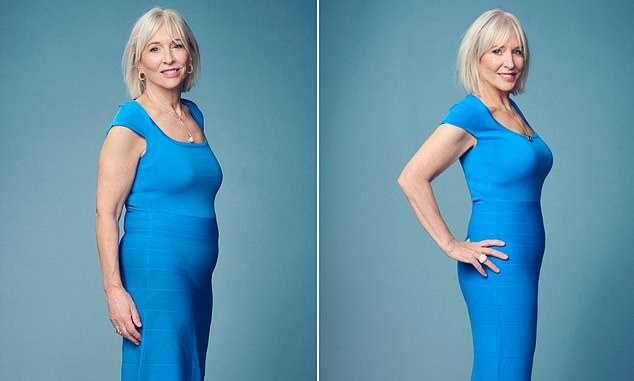 Nadine Dorries before she decided to take part in the Ozempic race - her excess weight was mainly around her waist