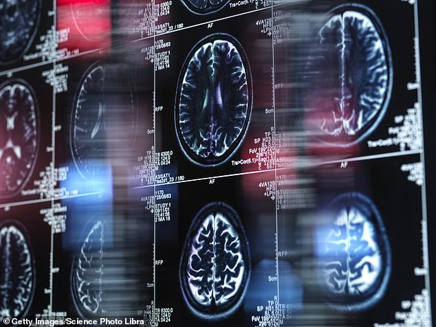 They estimate they will analyse up to 1.6 million images during the project, which they will use with approval from the Public Benefit and Privacy Panel for Health and Social Care, part of NHS Scotland (file image)