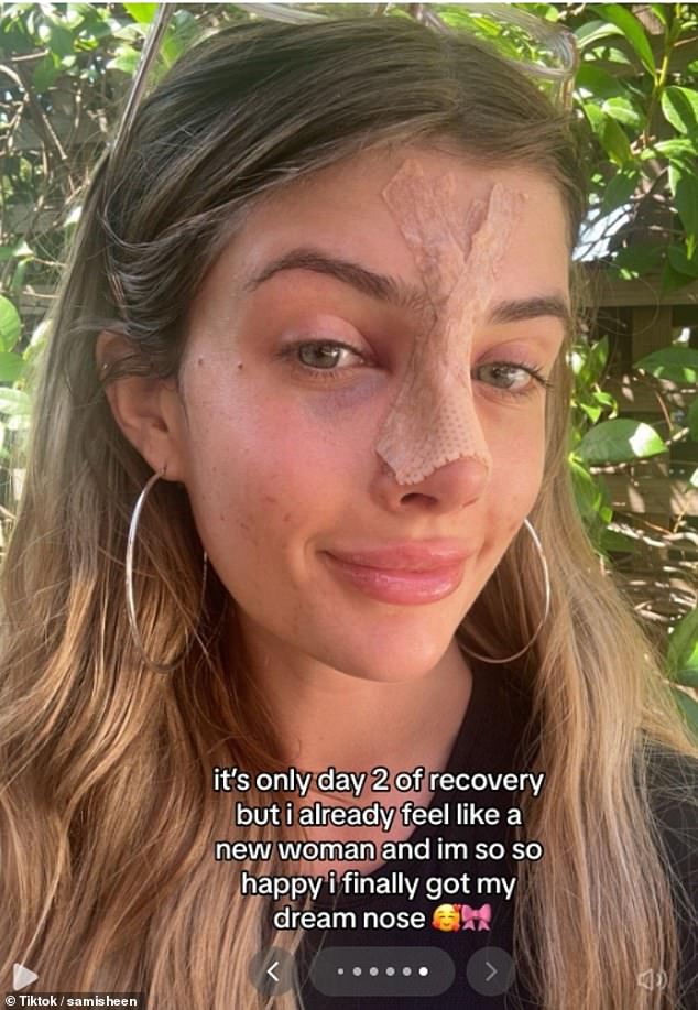 She shared the process of her recovery