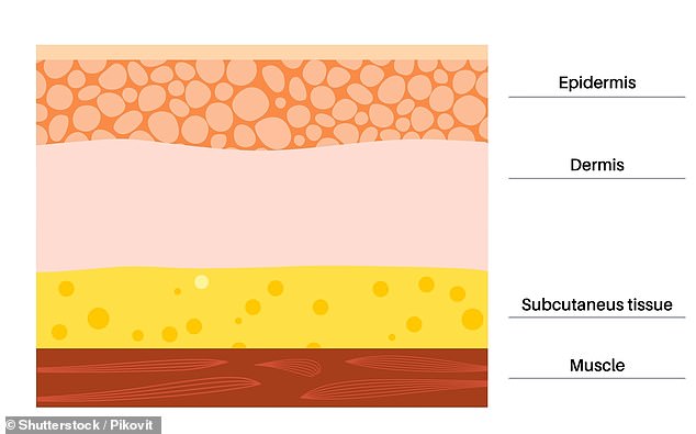 Lyma's research shows that light from LEDs cannot even reach the dermis, the second layer of skin where regeneration takes place.