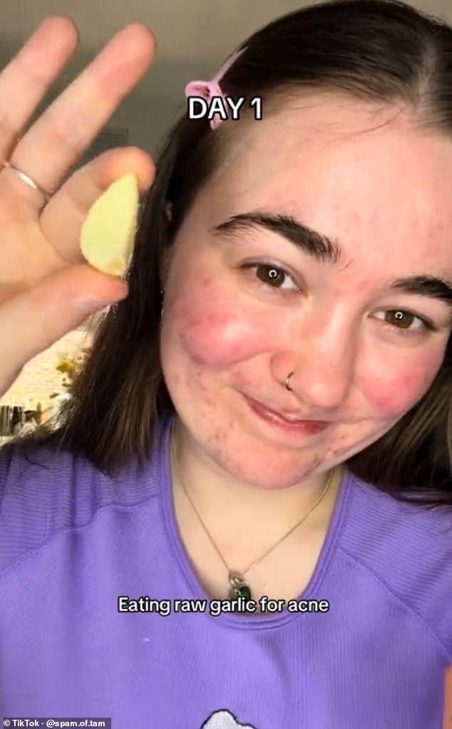 Others are incorporating the pungent remedy into their favorite skin care tips, though almost every video features people using the tip nearly gagging after trying to munch on a piece of garlic.