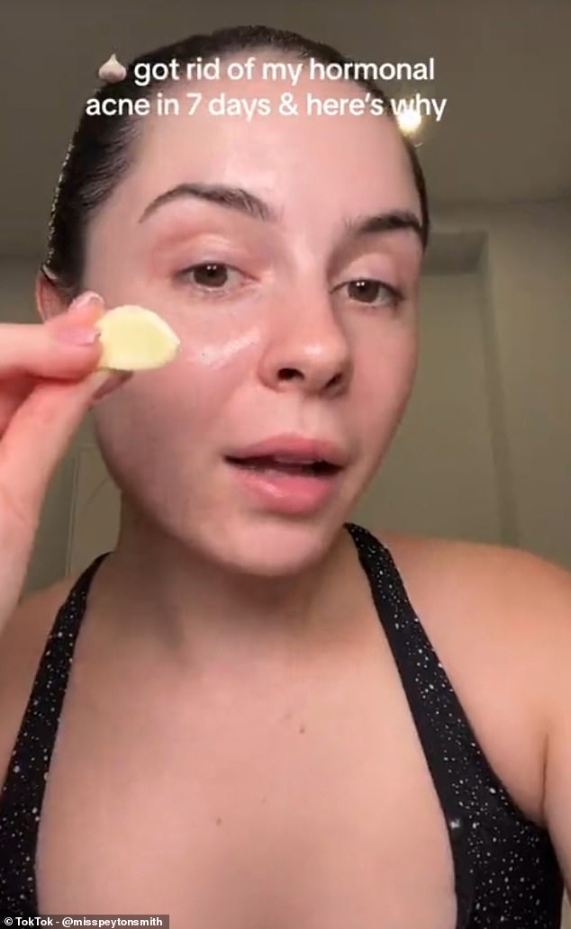 A number of clips under the hashtag show women attempting to cure various types of acne – including hormonal acne that can't be relieved topically – by chewing or rubbing garlic