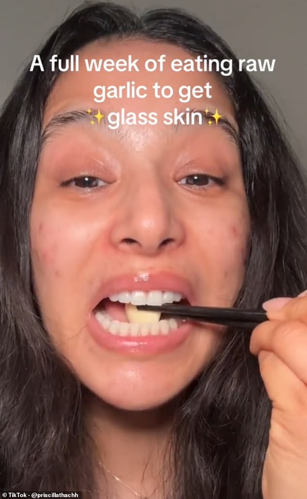 Another TikToker revealed she ate over 3,000 cloves of garlic in an attempt to get rid of her acne, explaining she was trying to get 